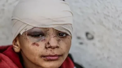 فلسطینی، شہادت، ہولناک،